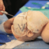 Neurosurgery