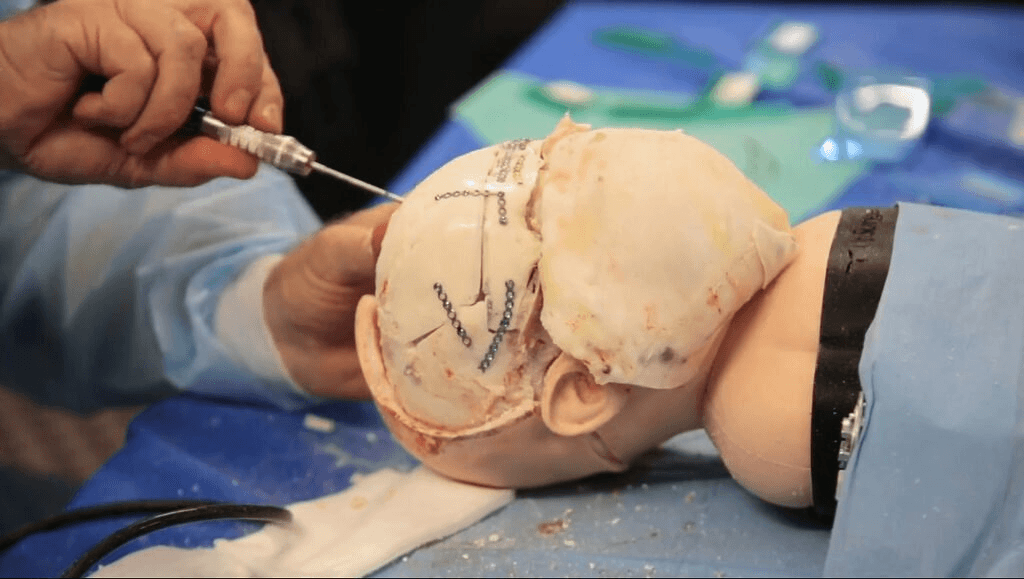 Neurosurgery
