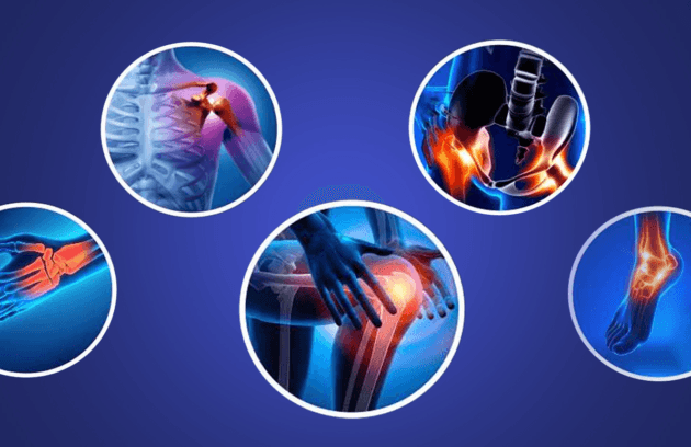 Orthopedics BMH